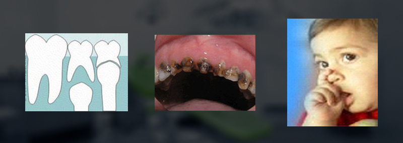 child-dentistry