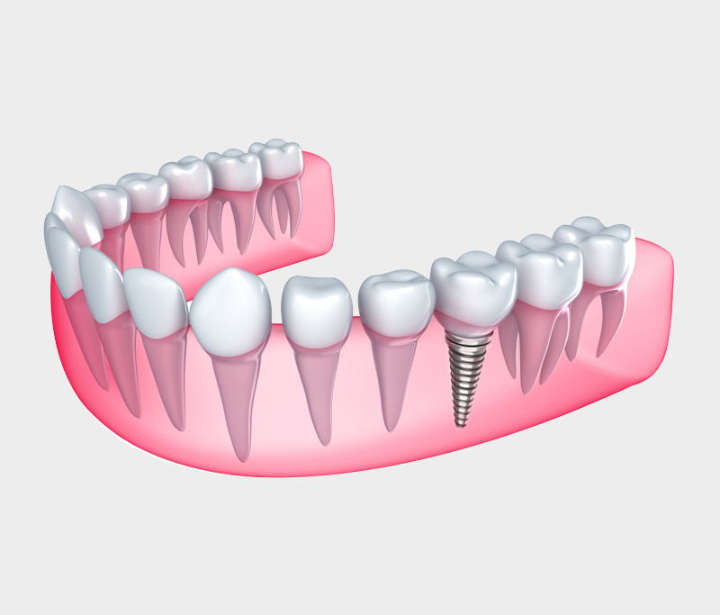 smita dental