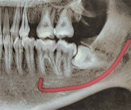 Oral Surgery