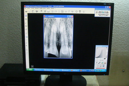 Radiovisiography