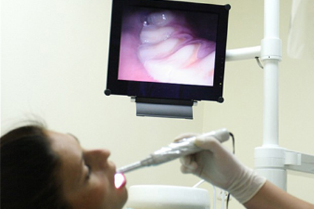 Intraoral Camera